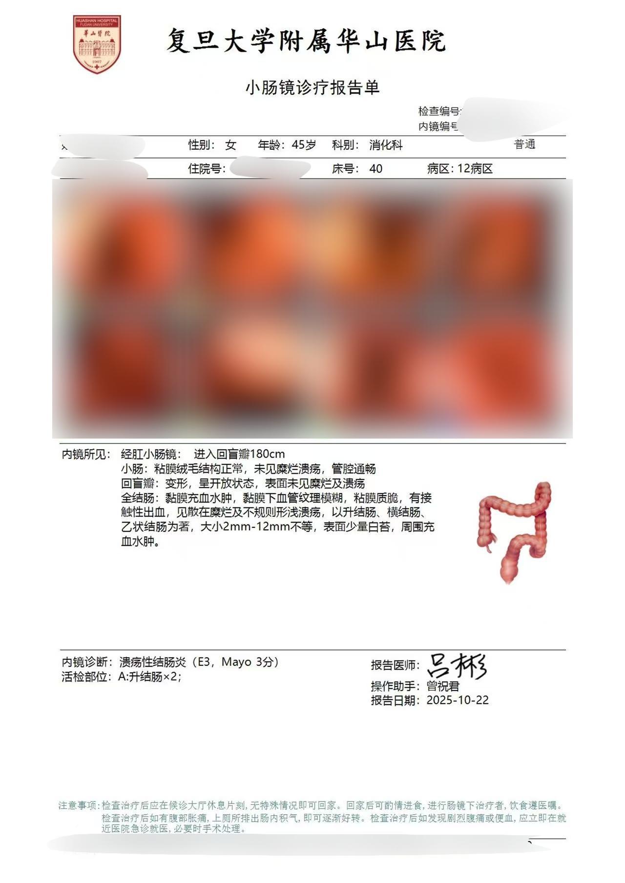 溃疡性结肠炎虽然容易反复，但只要医患配合、规律用药、定期随访，完全有希...