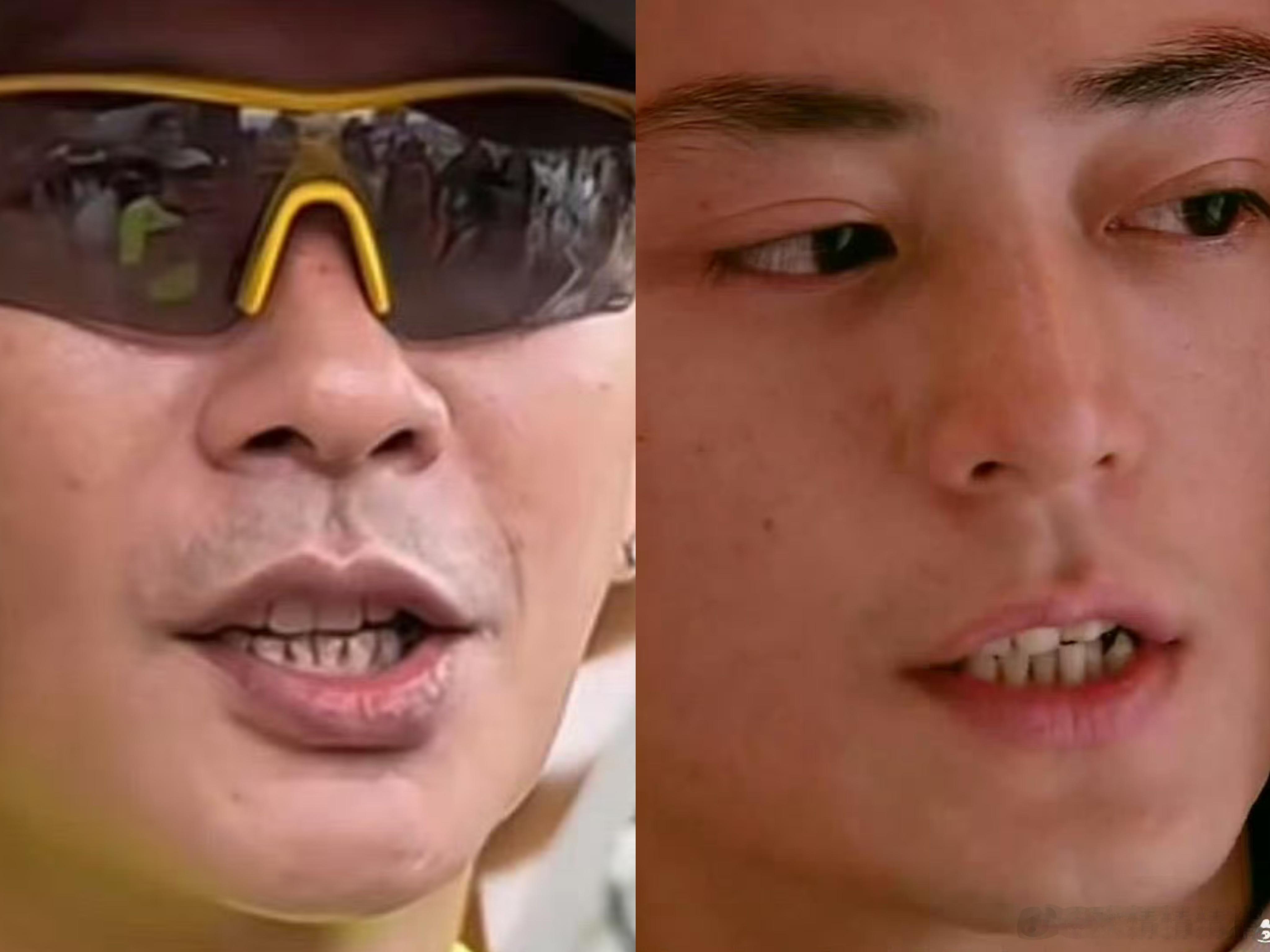 黄宗泽 牙龈萎缩为什么男神的牙这样，粉丝还幻想和他们亲亲吗？ 