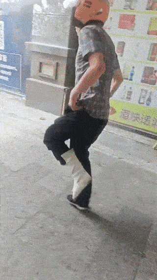 这个外卖小哥真是太拼了！
他的一只脚意外骨折受伤了，都舍不得住院治疗。
甚至还一