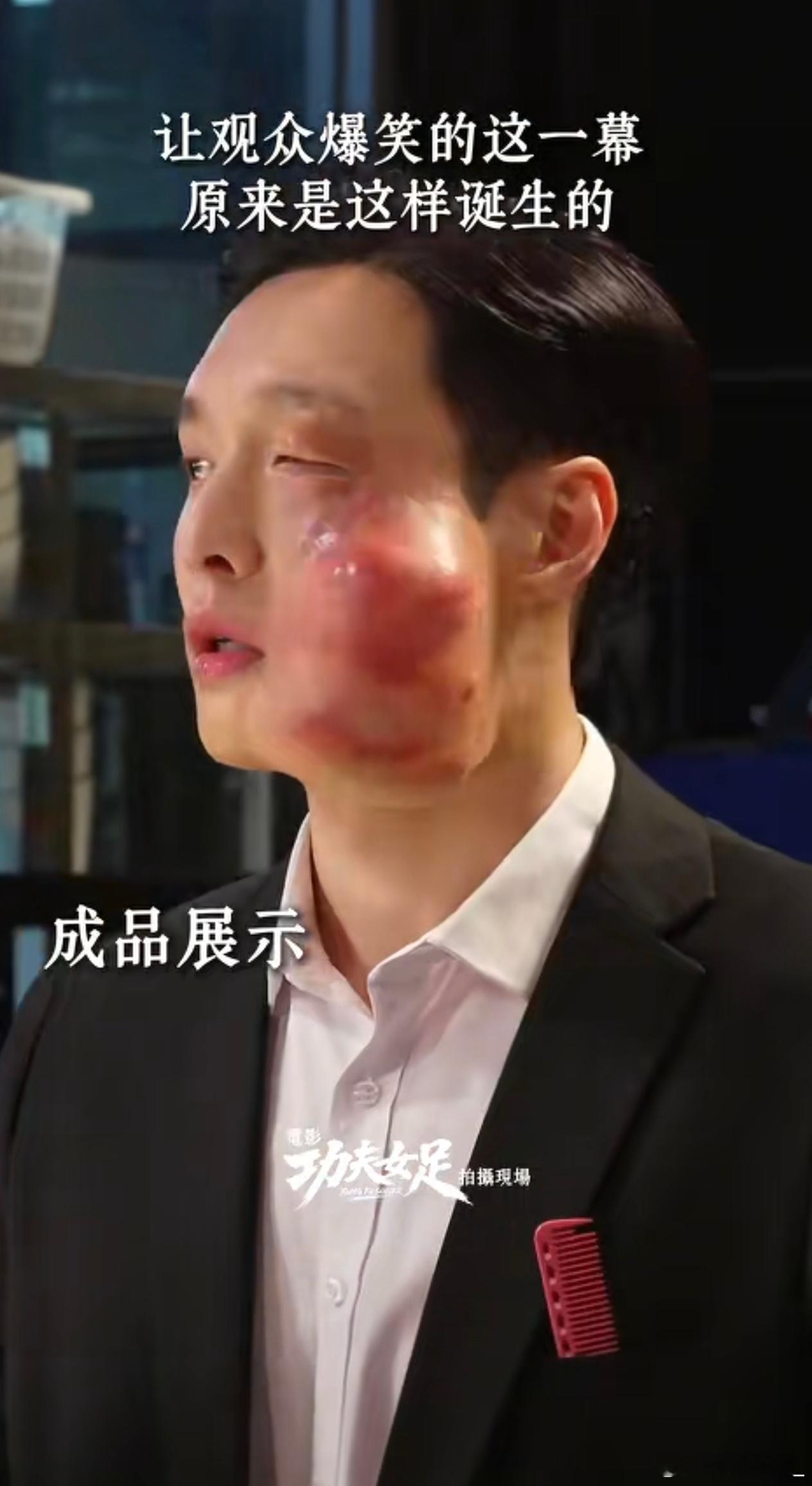 张艺兴肿脸特效妆张艺兴完全放下偶像包袱，片中挨打戏份的肿脸特效妆滑稽又真实，厚重