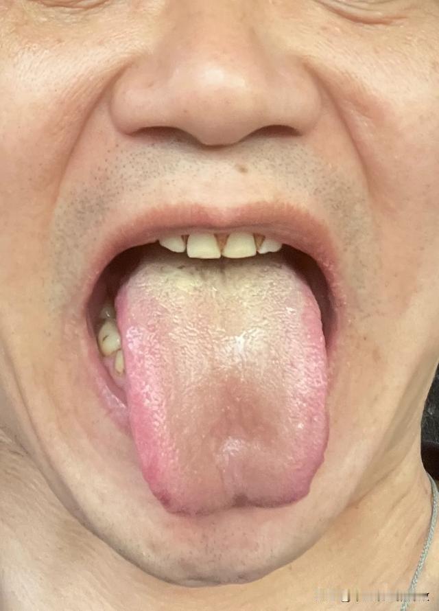 六味地黄丸，金匮肾气丸，打住，一粒都别再吃了[捂脸][捂脸][捂脸]
再吃下去，