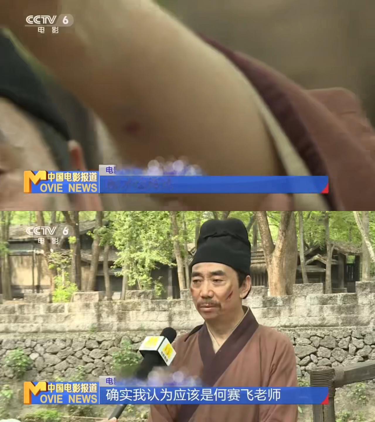 何赛飞把范明手臂咬紫了何赛飞把范明手臂咬了一排牙印 谁能想到拍戏实拍直接留下牙印