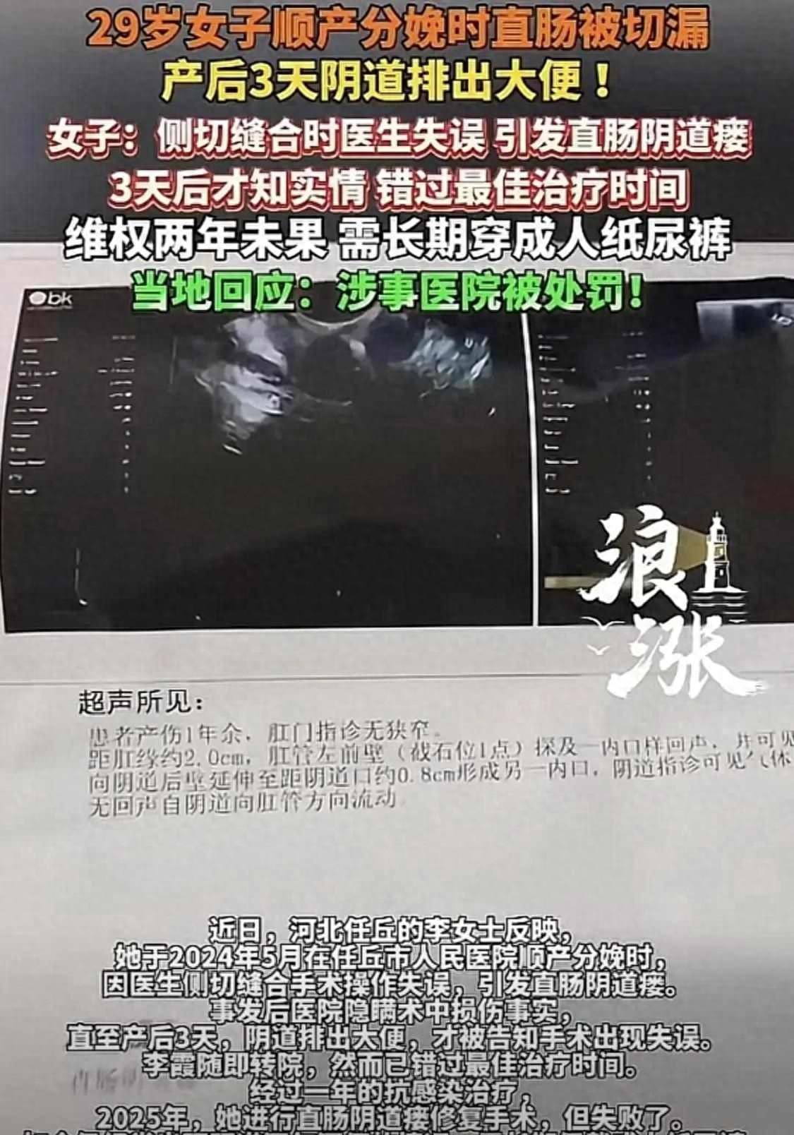 “太坑人了”河北任丘，29女子岁在某医院顺产生娃，3天后，突然在阴道里排出大便，