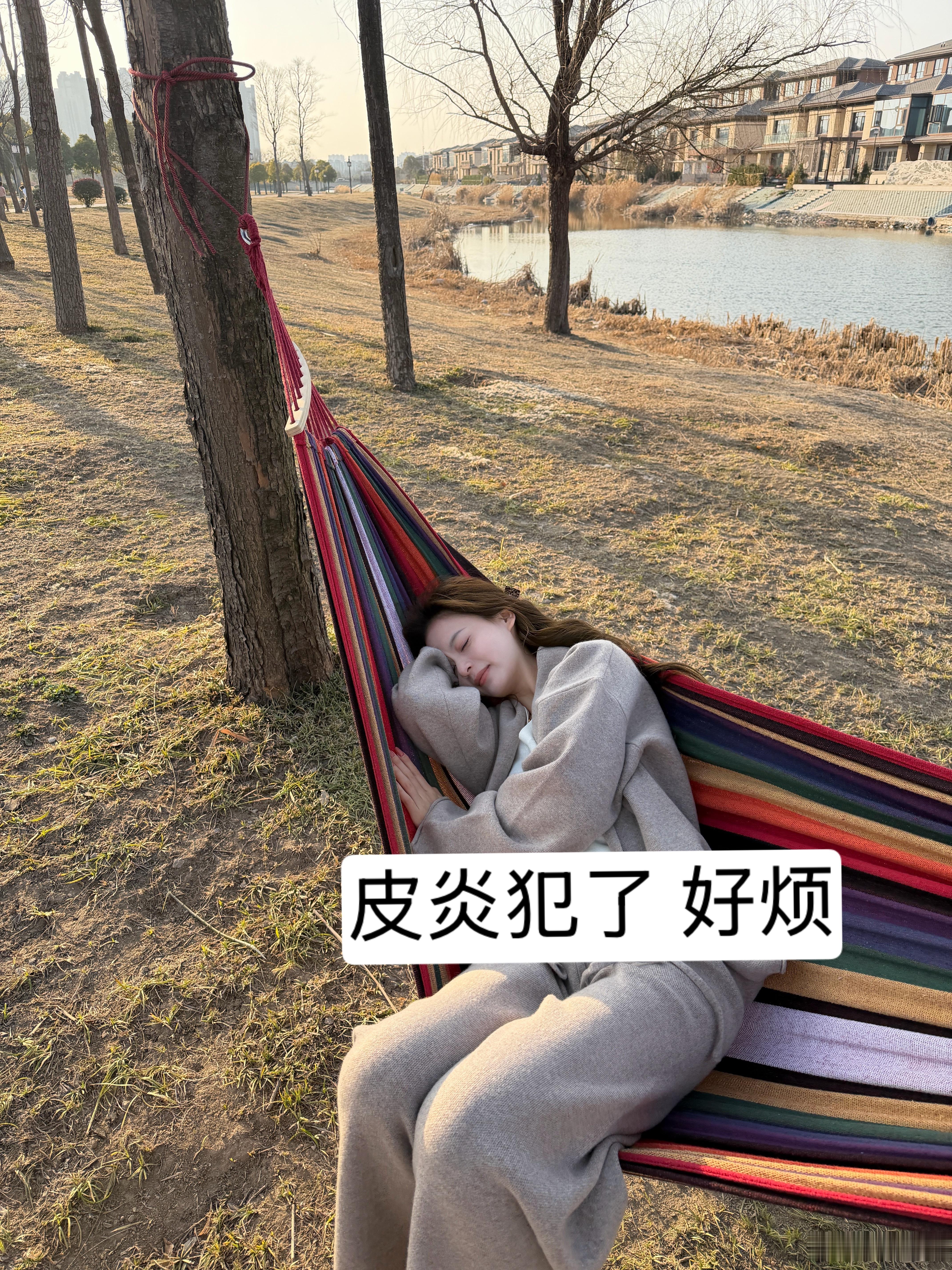 脂溢性皮炎滚出拆那 不化妆感觉有点丑 化完妆更是丑上加丑 鱼鱼了