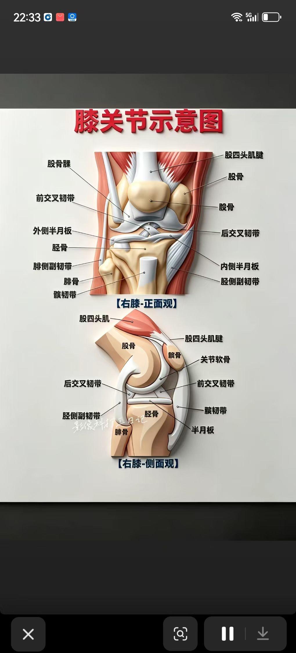 一号选手的膝盖历险记

今早七点四十五，我准时出现在医院挂号窗口。碰到一个熟人看