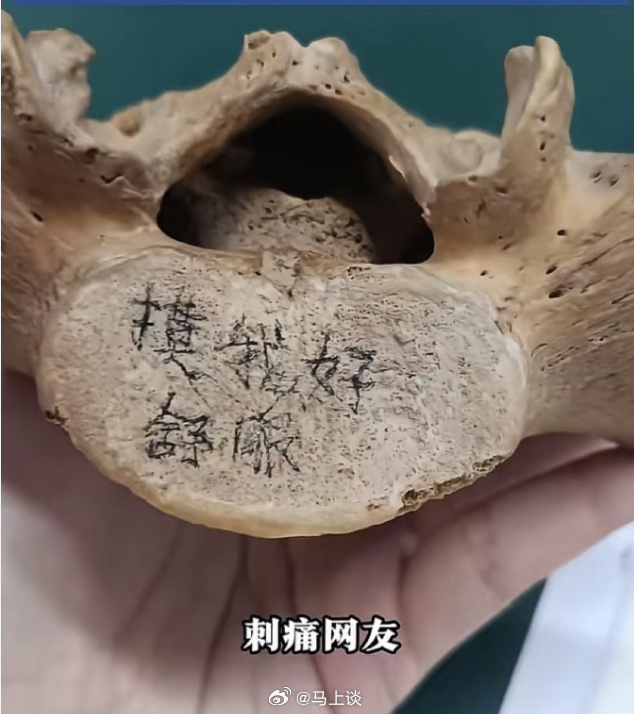 把大体老师遗骨当玩物配当医生吗 我觉得直接吊销从医资格或者开除学籍吧，对生命无敬