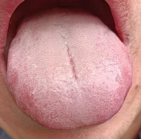 宗筋失养难振作，温养心肾固本调







不少上了年纪的朋友面临着身体身体虚