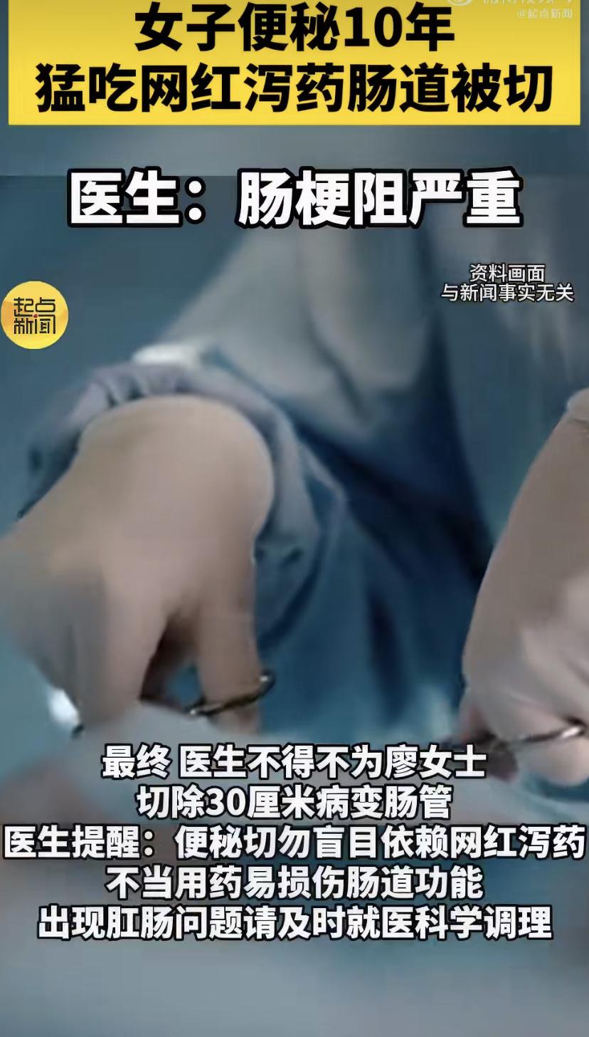 陕西一女子便秘10年，长期吃网红"通便神药"，结果肠道变黑坏死，切掉30厘米!