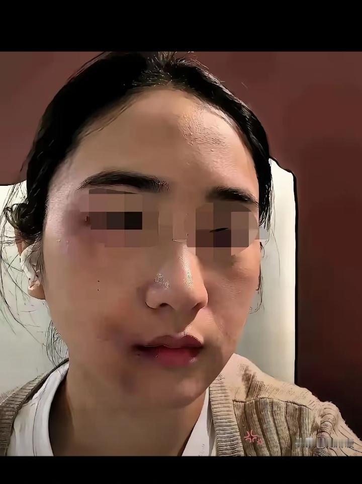 丈夫家暴妻子近十年，刚动手打完妻子三天，自己就确诊肝癌晚期，家人逼迫女方拿出全部