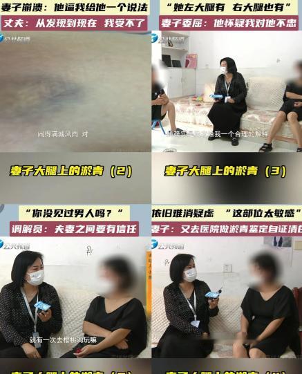 丈夫出差几天后凌晨3点回家后发现妻子两条大腿内侧都有明显淤青，要求妻子解释，还拍