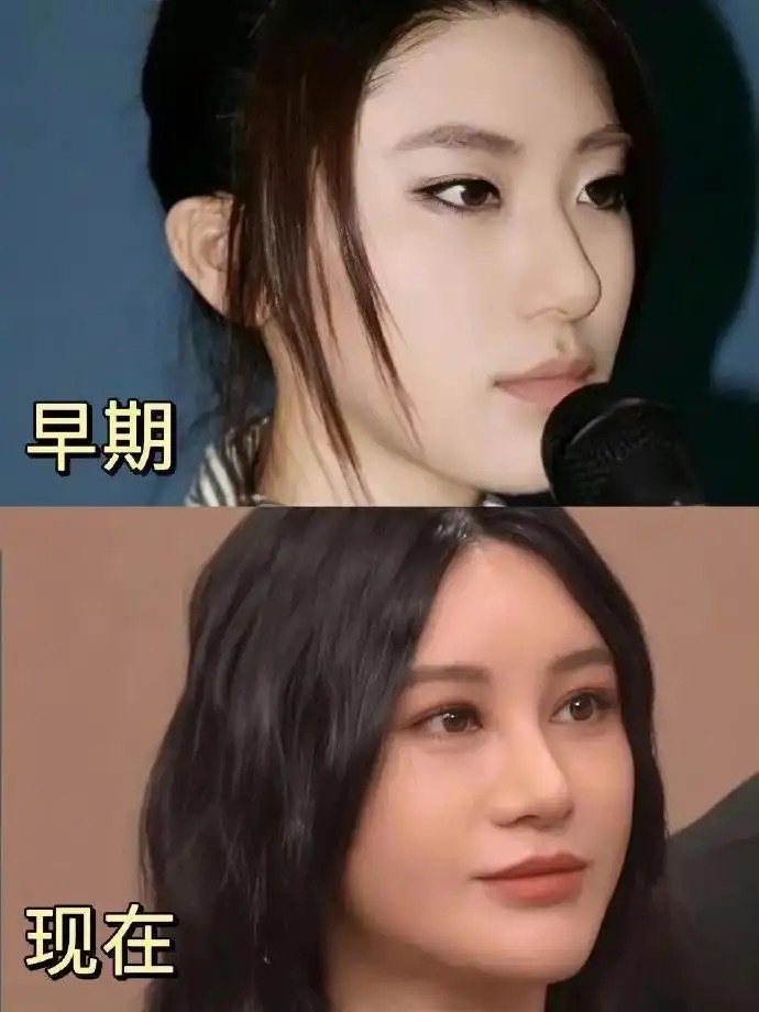 尚雯婕早期这么好看为什么想不开去微调 