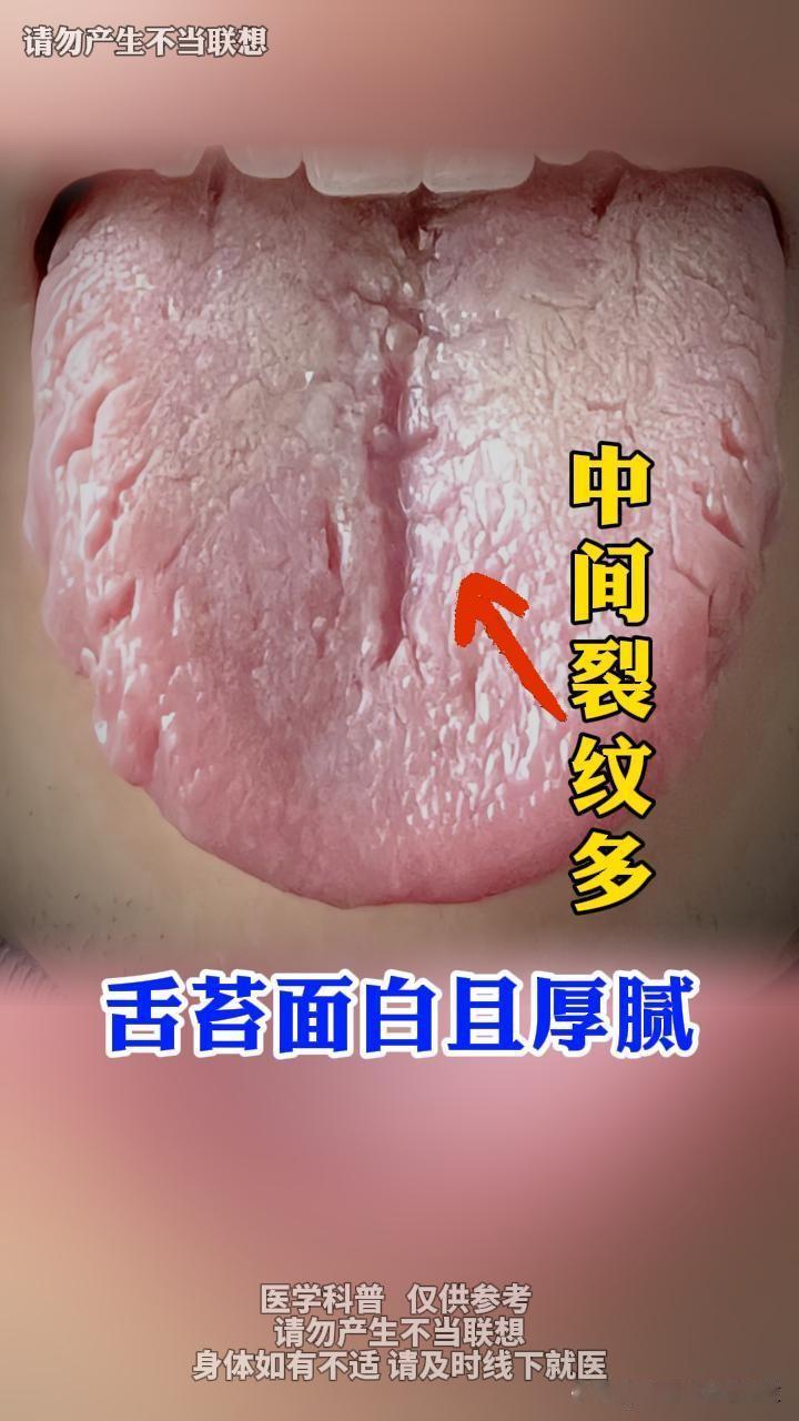 32岁深圳大哥，他是被他老婆逼着来的[捂脸][捂脸][捂脸]
疲软也就算了，关键