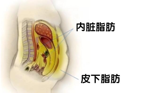 腹型肥胖确实比全身肥胖危害大得多1. 肚子胖=内脏脂肪高腰腹堆积的脂肪包裹心肝脾
