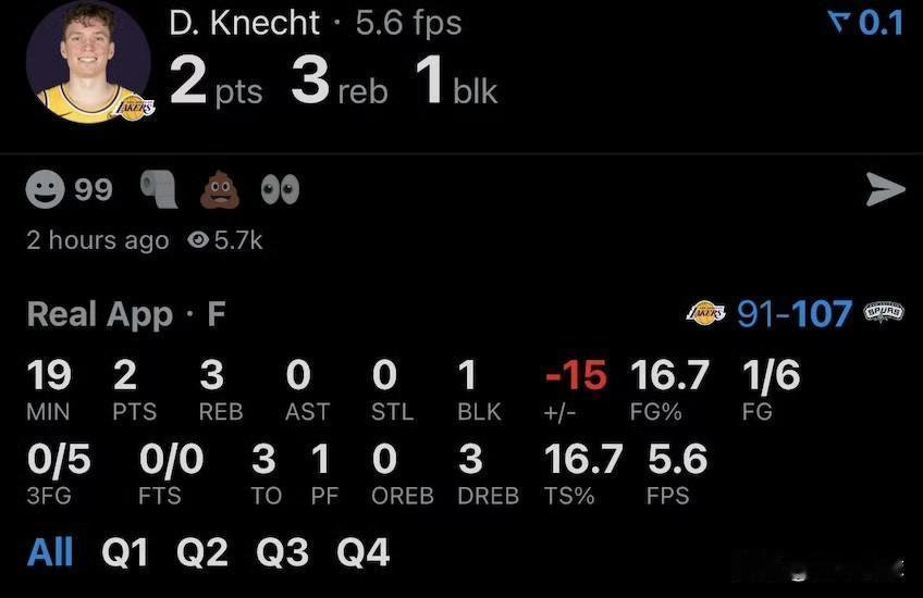 克内克特心魔难除啊！

今天湖人队客场背靠背对阵马刺队的比赛，由于詹姆斯、里弗斯