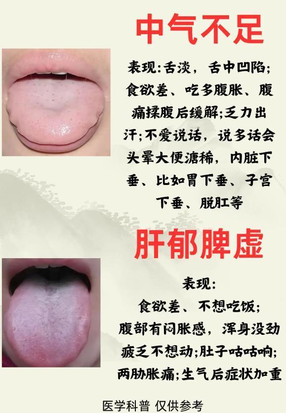 脾虚的 6 种不同证型，看舌头就能分清