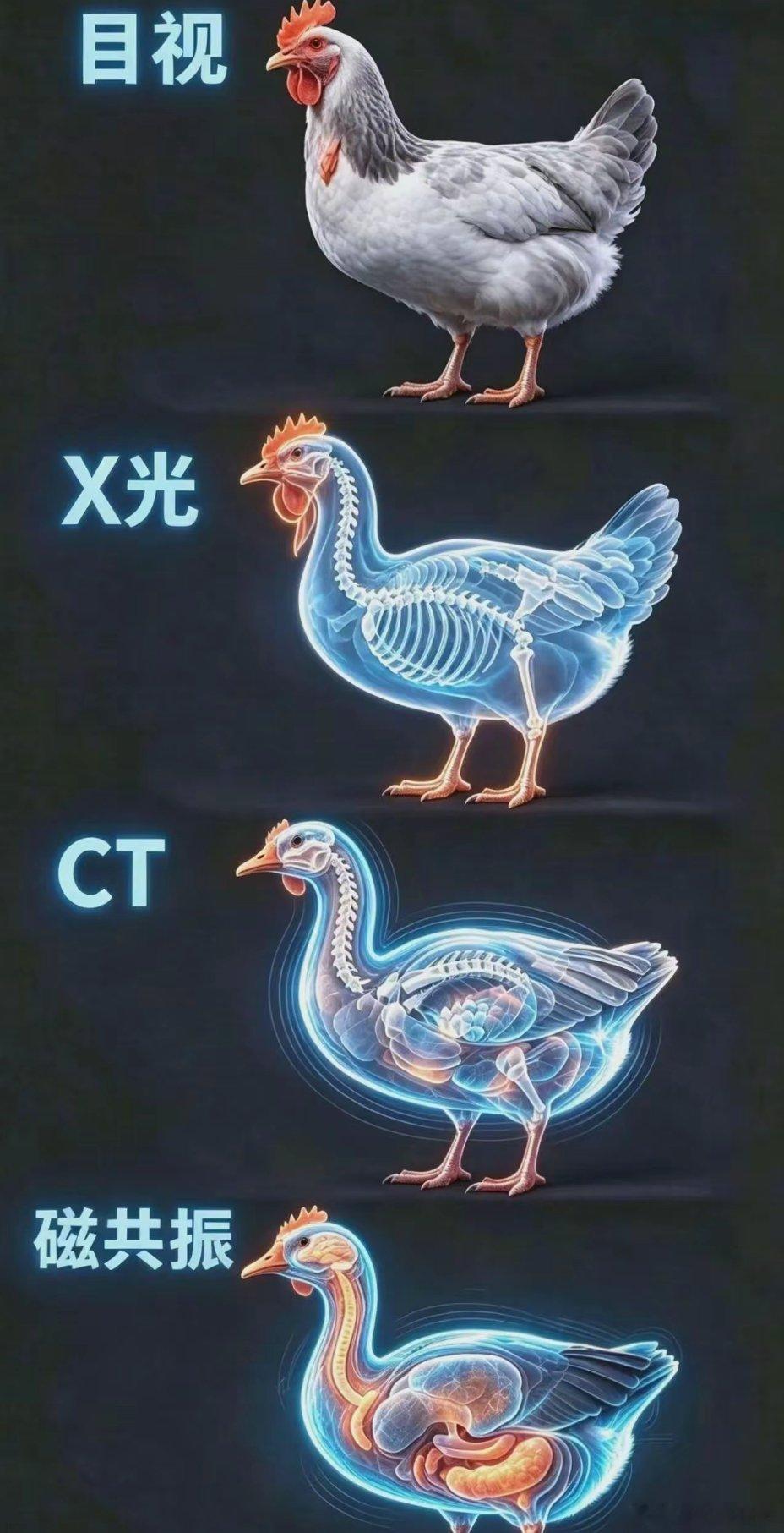 直观的感受到磁共振的厉害之处 ​​​
