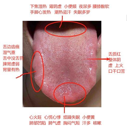 揭秘！揭秘！揭秘！潘大夫每天能帮粉丝看多少个舌象？只能帮忙看10个，舌象再多真的