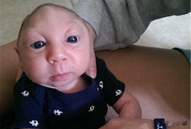 美国夫妻的伟大抉择：让仅活4天的无脑宝宝，成为他人的光

美国佛州一对夫妻的故事