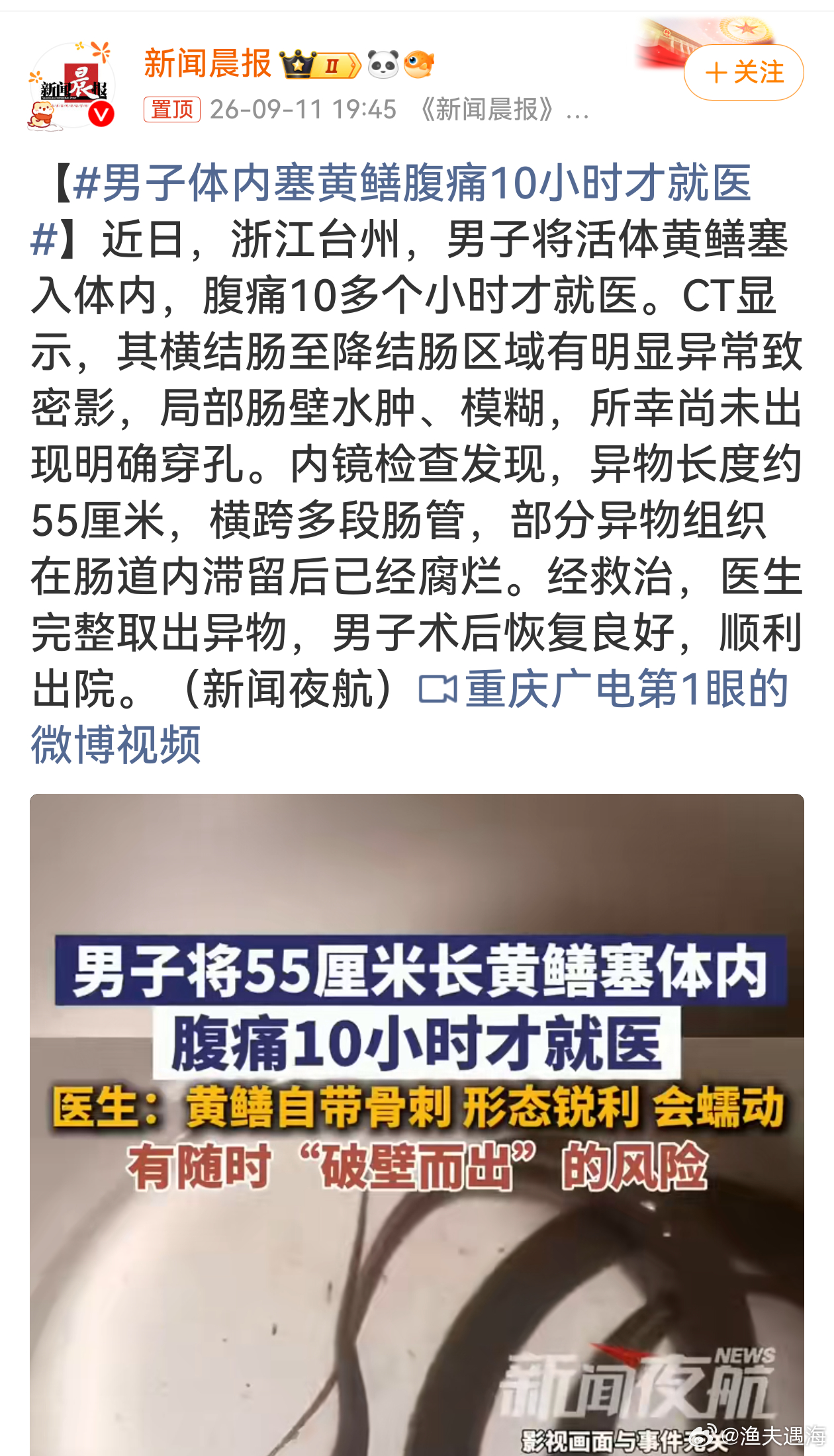 男子体内塞黄鳝腹痛10小时才就医不管是信偏方还是猎奇，这种行为都是拿命冒险，一旦