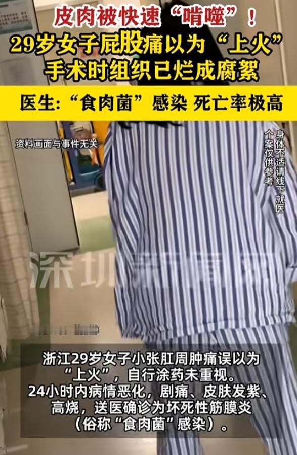 “悲剧还是发生了！”7月25日报道，浙江，一女子肛周肿痛，她以为是“上火”，涂了