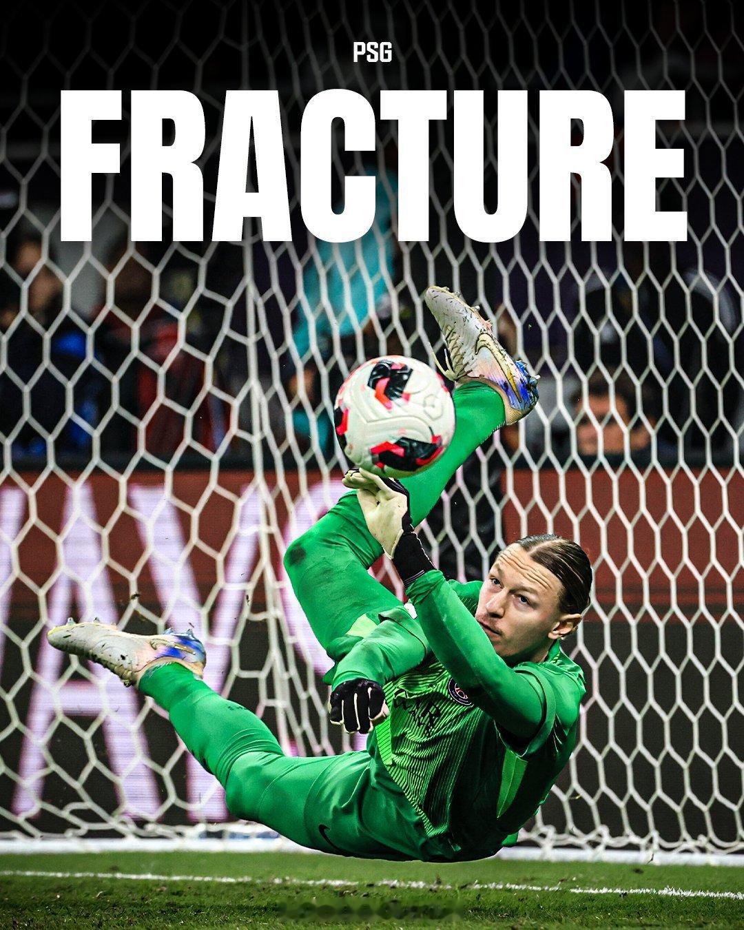 巴黎圣日耳曼 萨福诺夫点钱大战时手部骨折，另有两人法国杯 无缘对阵丰特奈巴黎圣日