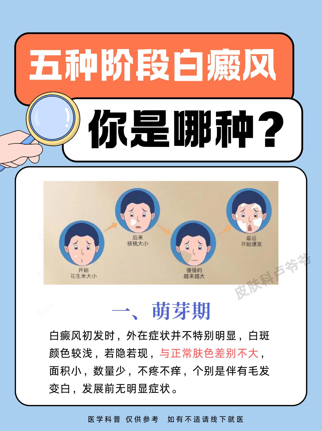 白癜风的5个阶段。