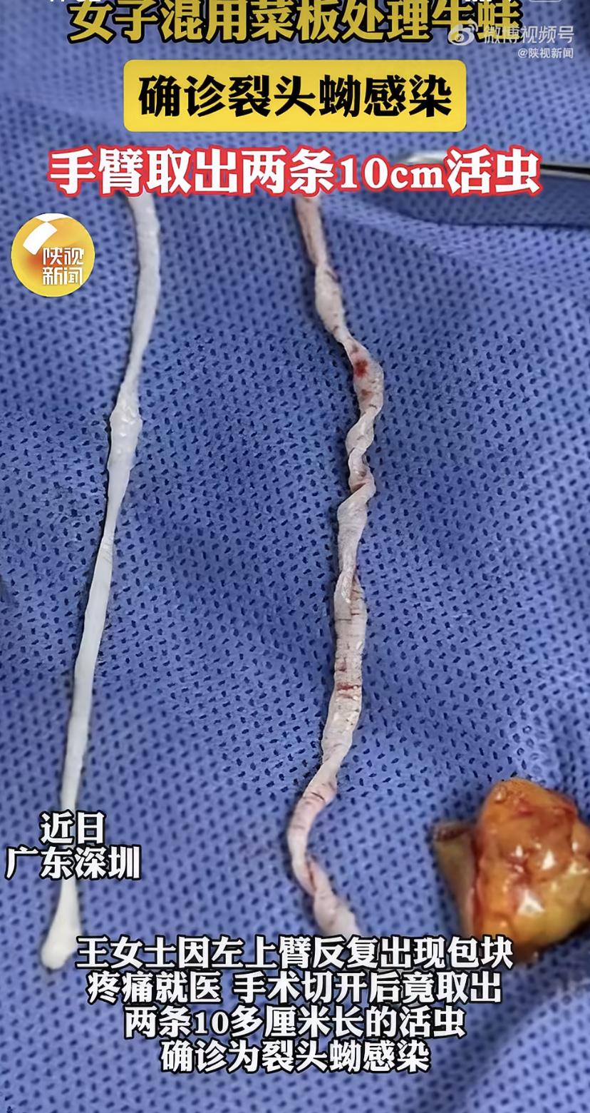 深圳女子胳膊里揪出活虫，还在动!厨房这个习惯太坑了
深圳的王女士最近吓坏了。她左