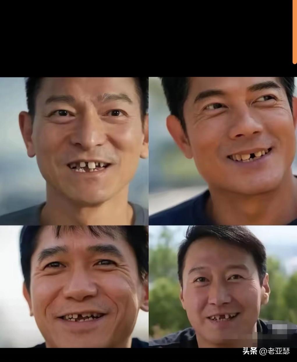这网图也实在是太损了吧。
论牙齿的重要性。
明天好好保护自己的牙齿。
饭后一定要