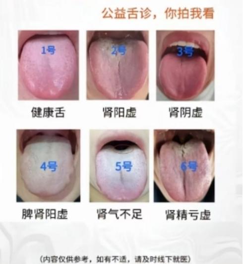 让男同志深受困扰的六大舌象，你的舌头和几号像？

搞不清楚的可以你拍我看，挨个分