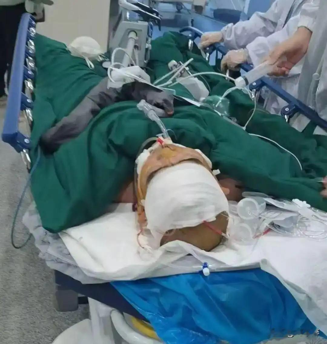 3人喝酒中毒，1人死亡、1人脑死亡、1人正在抢救
11月21日，湖北十堰某公司三