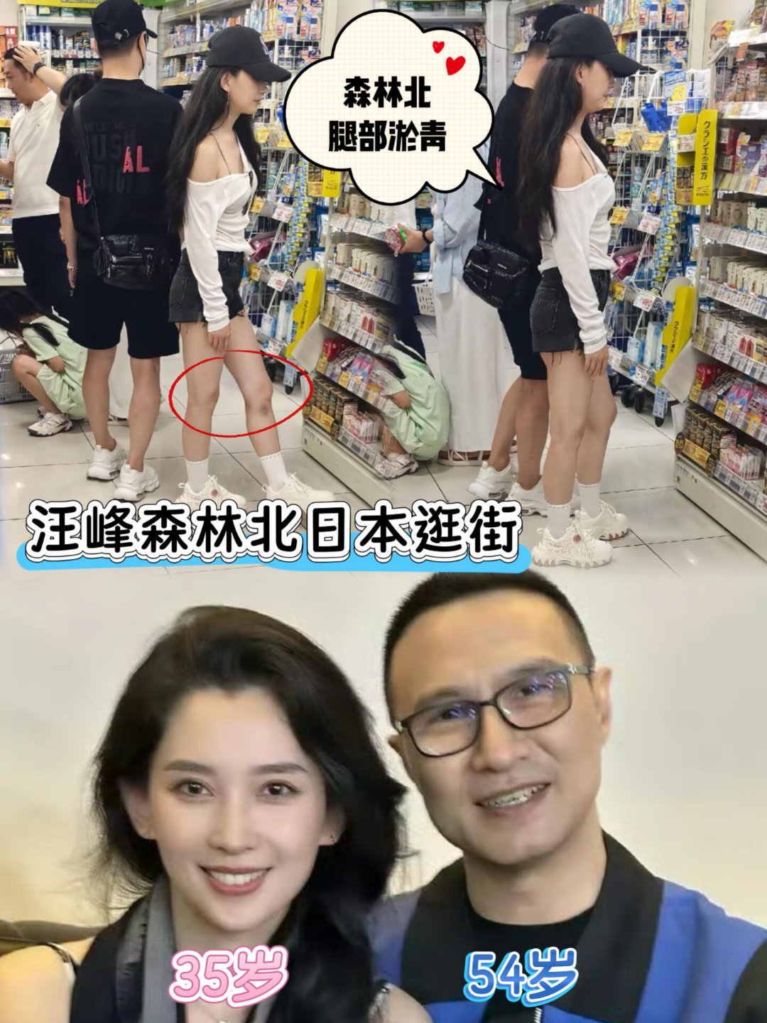 汪峰带着森林北在日本药店低调买药，森林北膝盖下方一片淤青，汪峰全程陪在旁边挑选很