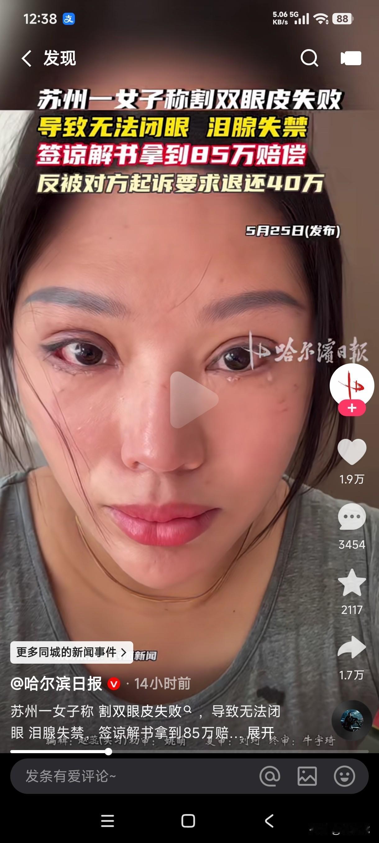 苏州一女子割双眼皮失败导致双眼无法闭眼，泪腺失禁，签谅解书拿到85万赔偿后反被对