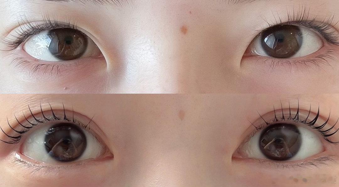 不同的眶骨条件做上眼角，呈现的效果：突眼做上眼角暴露的效果会比内陷型的眼睛更明显