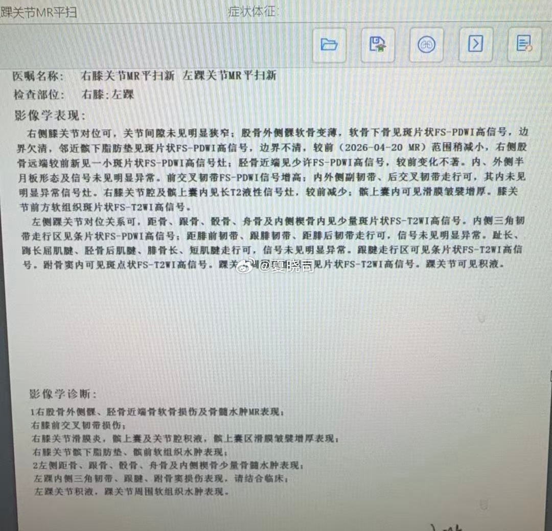 这是回到济南的检查，还是右膝左踝，高诗岩这得歇一阵子了，然后就去美国康复理疗恢复