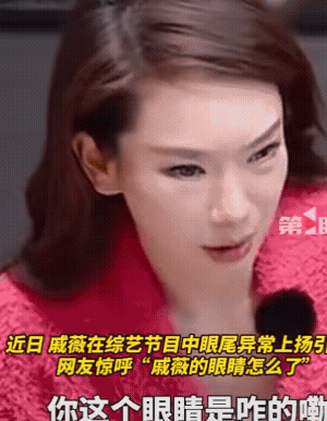 戚薇大方承认医美过度一沫真挚的情话[超话]戚薇大方承认医美过度！一沫真挚的情话 
