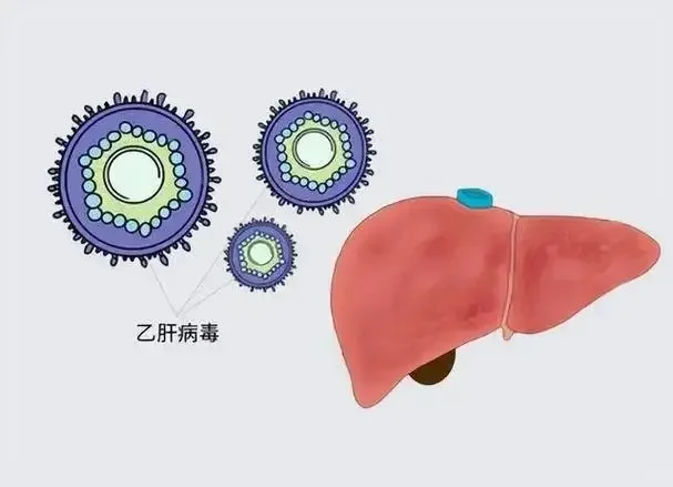 乙肝能治愈了？关键这一步，很多人走错了