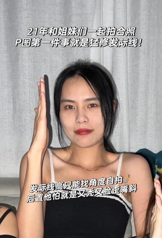 从图一到图2，这就是植发的意义吧