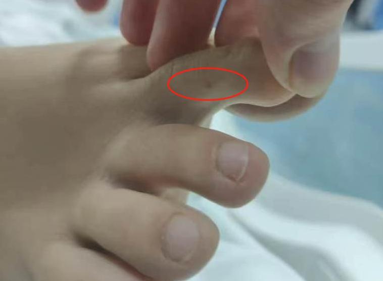【27 岁女孩三亚旅游蛇咬致死案，医院和景区到底谁该 “背锅”？】#律师解读女子