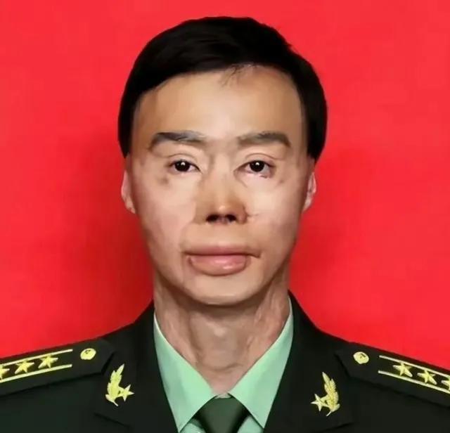 请不要吝啬您的双手，为英雄点赞！
那一年，他19岁，舍身抱走点燃的简易加油器，挽