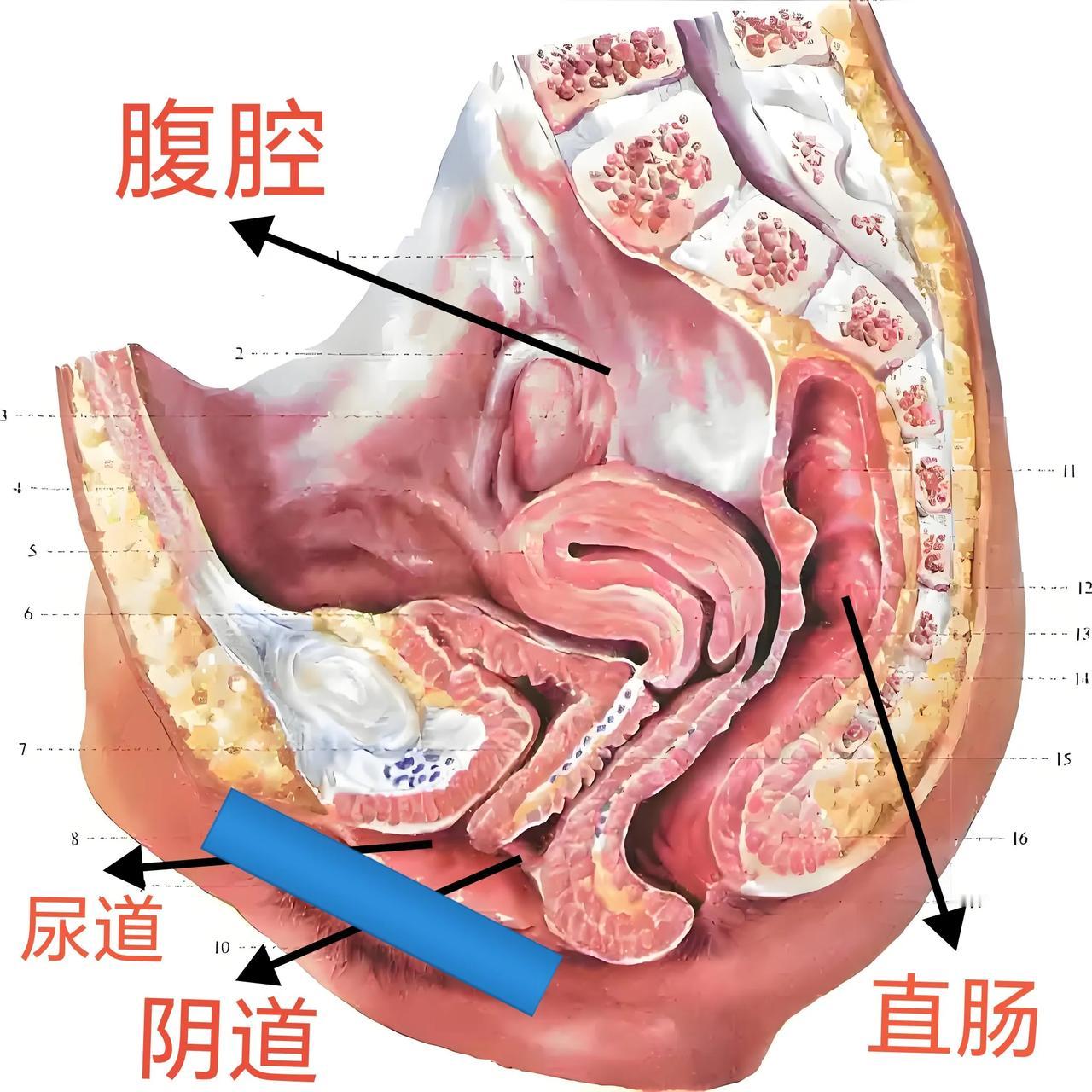 畜牲！[发怒]
印度女子，被丈夫“强暴”致死！

事情发生在2017年12月，神