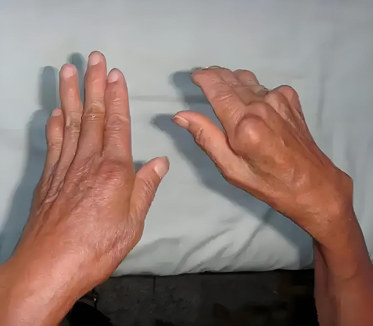 住得潮湿才会得风湿病？别再搞错根源了？！
 
不少人对风湿病的认知，一直停留在“