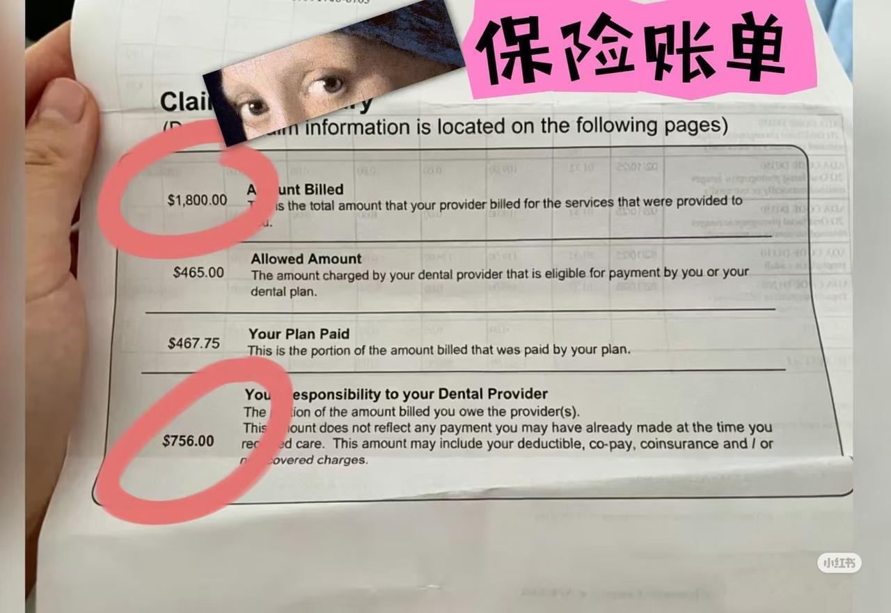 在美国看病真贵呀，补一颗牙理论上花了1800多美元。

一个人在美国诊所补牙，