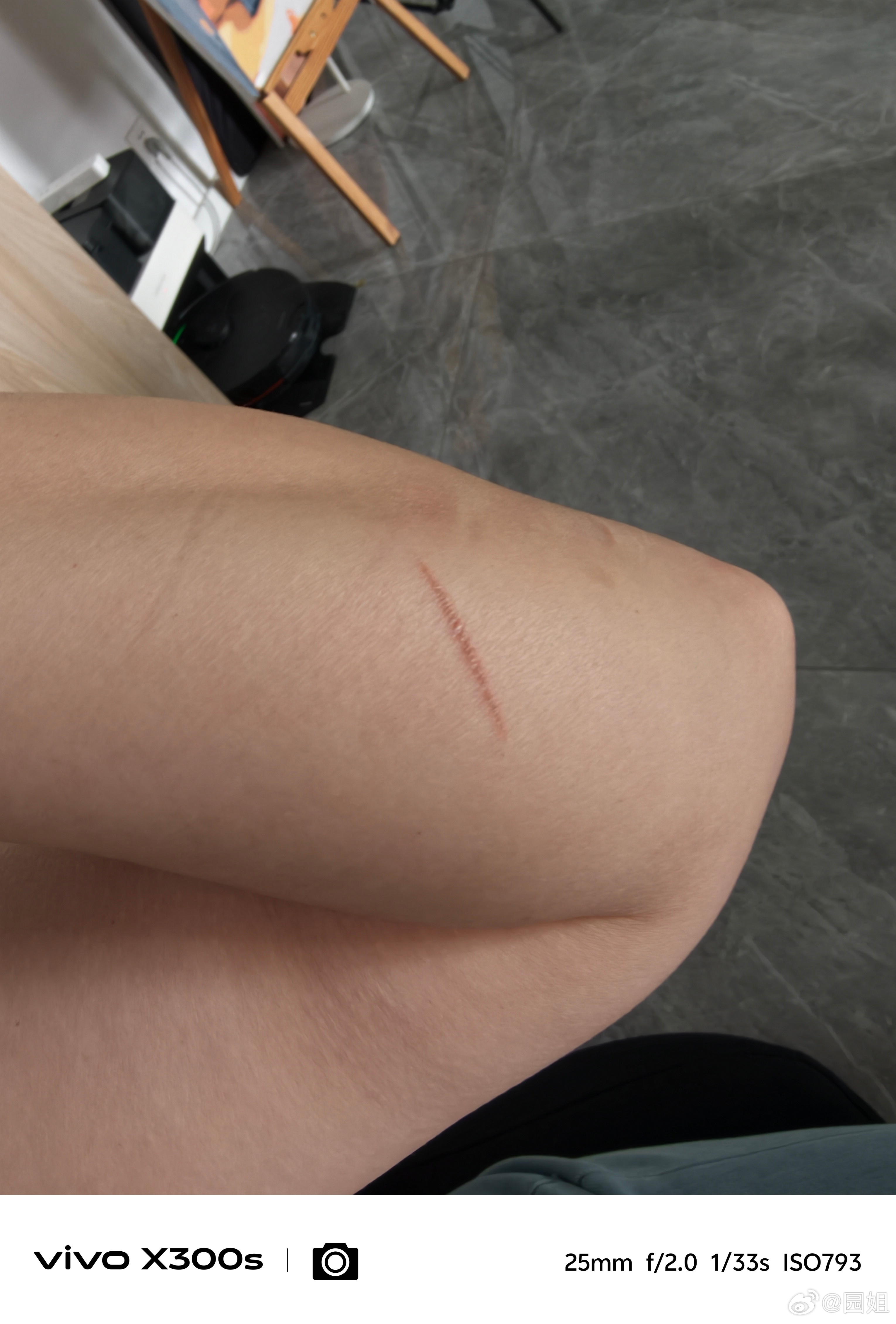 我做饭习惯就是灶台周围不能有油，所以我都是一边炒菜一边擦。后果就是经常烫胳膊