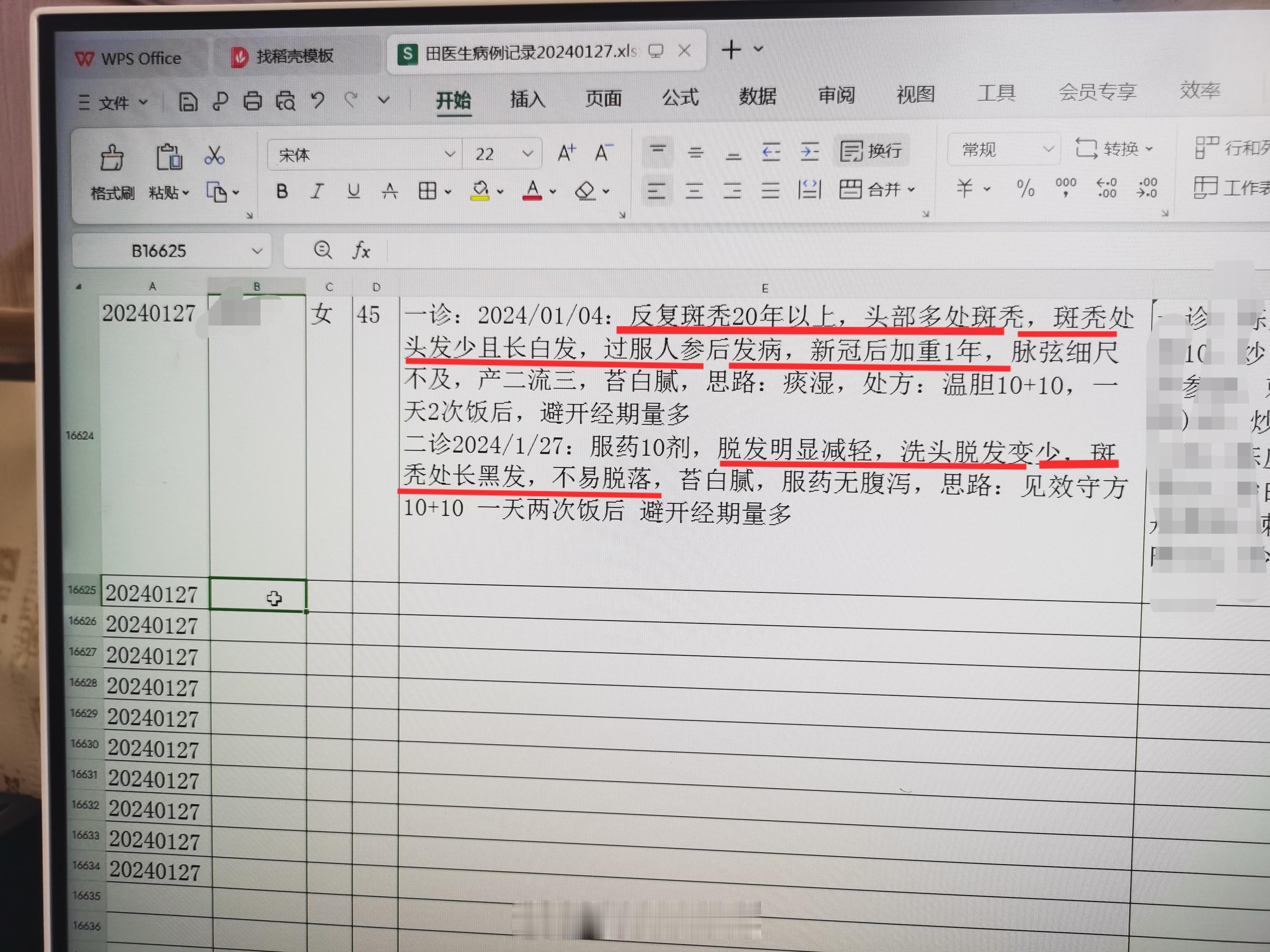 #中医##斑秃#  女 45岁  反复斑秃多年，头部多处斑秃，斑秃处头发少易脱落