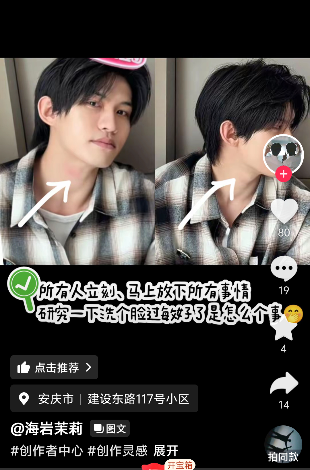 哎呦我去，我都没发现，挠红了的脖子，是洗把脸就没了印迹吗？？？？ 