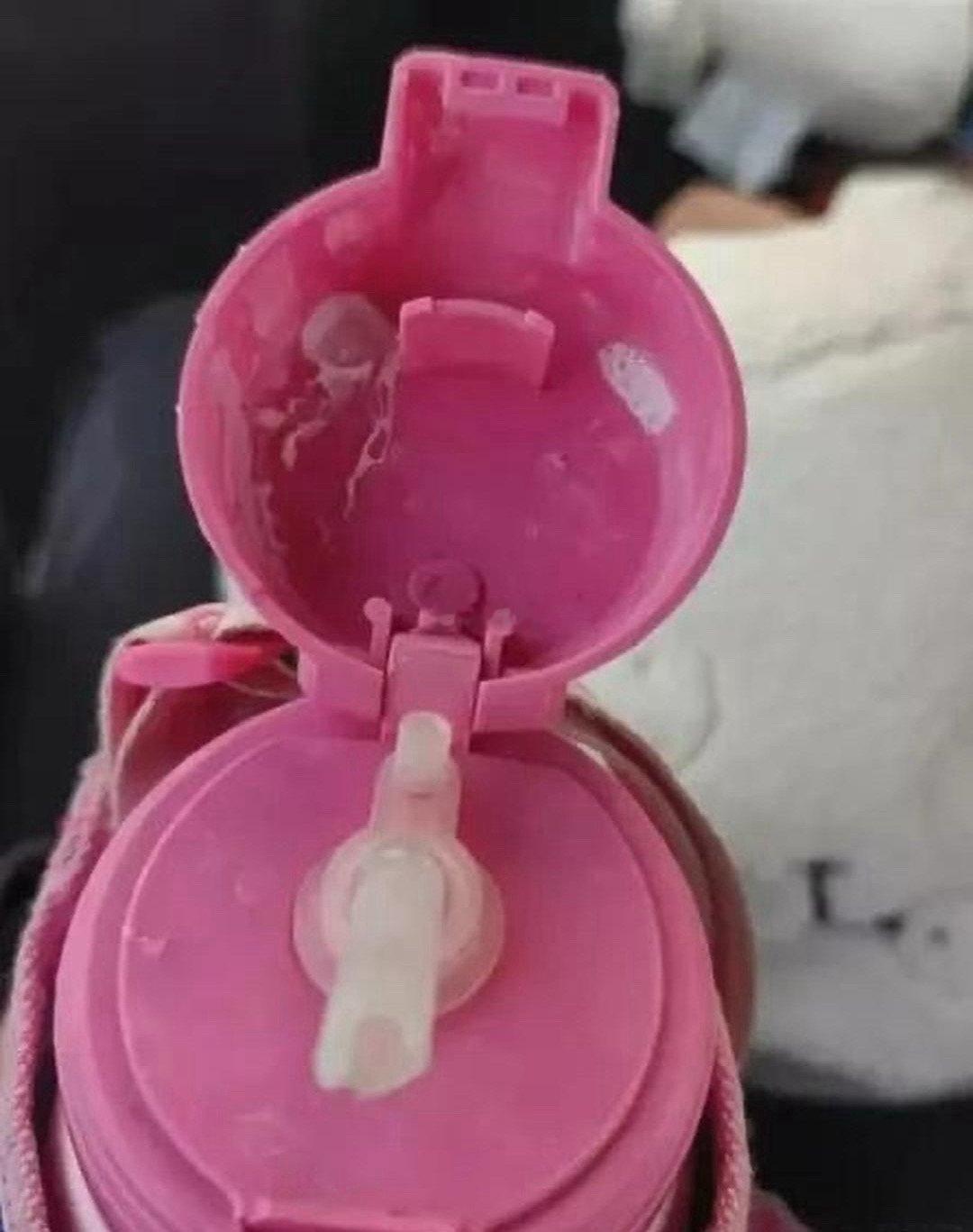 这才一年级啊 幸亏提前发现了