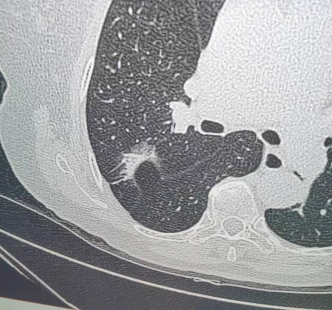 门诊接诊过一位30岁的年轻妈妈，说起来这事儿还挺让人感慨的——自从有了孩子，人好