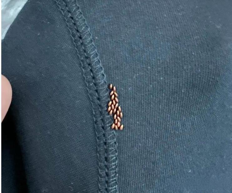 衣服放在柜子里有这个是虫子吗