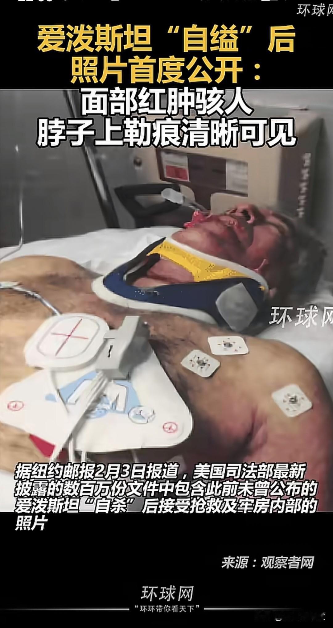 当地时间2月3日，美国司法部开始陆续披露一些关于爱泼斯坦系列的事情，有文字、讯息