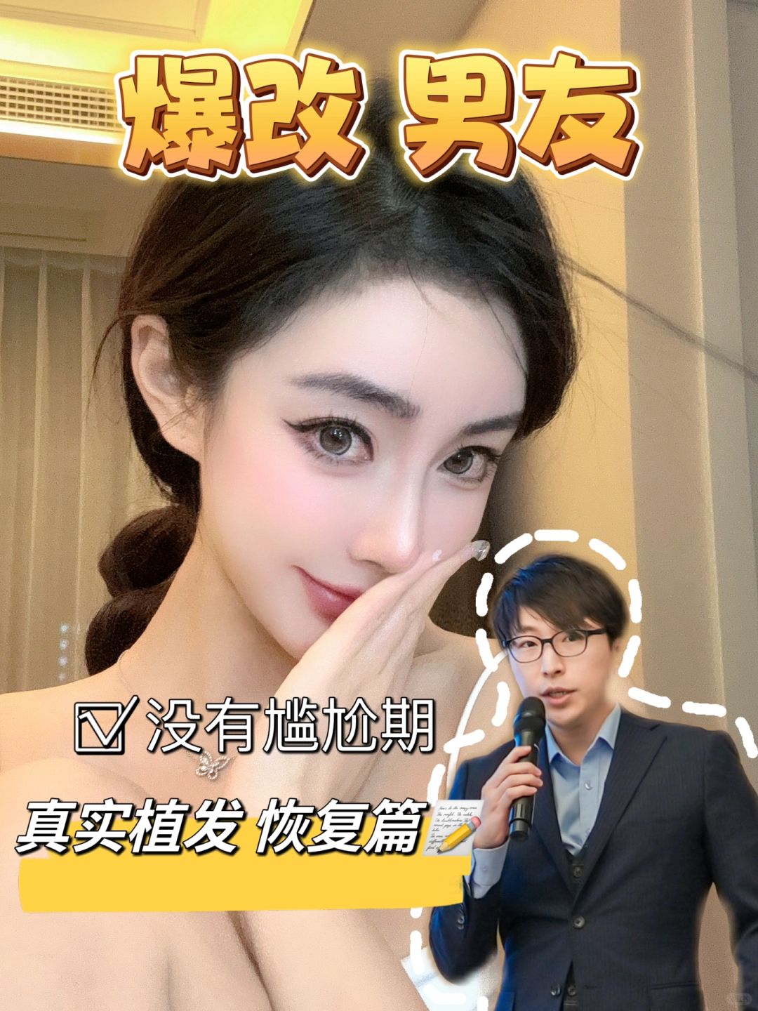 爆改男友之 植发恢复篇1